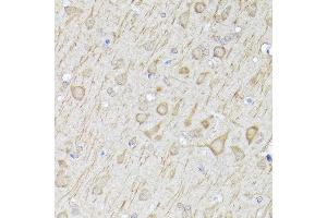Immunohistochemistry of paraffin-embedded rat brain using [KO Validated] LC3B Rabbit pAb (ABIN6134220, ABIN6143470, ABIN6143475 and ABIN6215146) at dilution of 1:100 (40x lens). (LC3B 抗体  (AA 1-100))