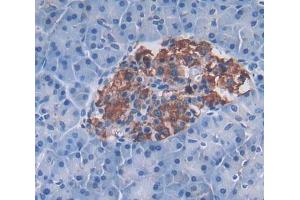 Immunohistochemistry (IHC) image for anti-Activin Receptor Type 1C (ACVR1C) (AA 21-493) antibody (ABIN5013073)