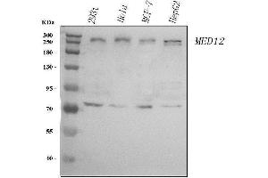 Western blot analysis of MED12 using anti-MED12 antibody (ABIN7602421).