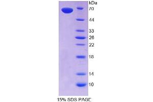 SDS-PAGE analysis of Human CLEC11A Protein. (CLEC11A 蛋白)