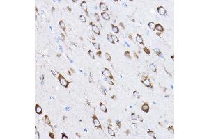 Immunohistochemistry of paraffin-embedded rat brain using RPL8 Rabbit pAb (ABIN6128659, ABIN6147155, ABIN6147156 and ABIN6214154) at dilution of 1:50 (40x lens). (RPL8 抗体  (AA 1-257))