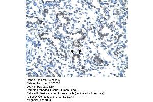 Human Lung (EVX1 抗体  (N-Term))