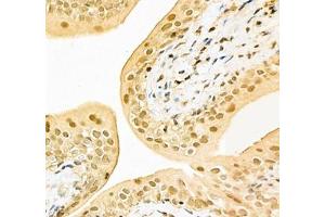 Immunohistochemistry (Paraffin-embedded Sections) (IHC (p)) image for anti-Poly A Binding Protein Nuclear 1 (PABPN1) antibody (ABIN7075116)