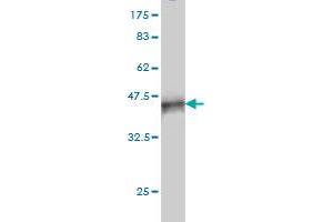 Western Blot detection against Immunogen (37. (RIPK4 抗体  (AA 675-784))