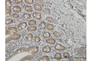 Image no. 2 for anti-N-Myc (And STAT) Interactor (NMI) (AA 1-101) antibody (ABIN598595) (NMI 抗体  (AA 1-101))