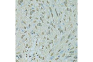 Immunohistochemistry (Paraffin-embedded Sections) (IHC (p)) image for anti-Scaffold Attachment Factor B (SAFB) (AA 1-200) antibody (ABIN6147357)