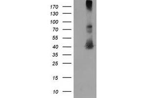 Western Blotting (WB) image for anti-Microtubule-Associated Protein, RP/EB Family, Member 2 (MAPRE2) antibody (ABIN1499315) (MAPRE2 抗体)