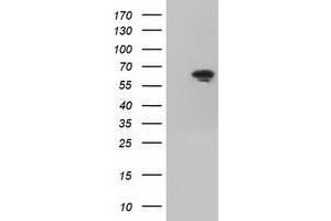 HEK293T cells were transfected with the pCMV6-ENTRY control (Left lane) or pCMV6-ENTRY IGF2BP2 (Right lane) cDNA for 48 hrs and lysed. (IGF2BP2 抗体)