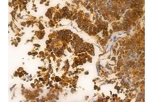 ABIN6262192 and ABIN6266561 at 1/100 staining human pituitary adenoma by IHC-P. (HDAC9 抗体  (C-Term))