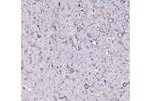 IHC analysis of FXR1 using anti-FXR1 antibody (ABIN7600093). (FXR1 抗体  (AA 149-614))