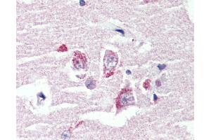 Anti-GPR98 antibody IHC of human brain, cortex. (ADGRV1 / GPR98 抗体  (N-Term))
