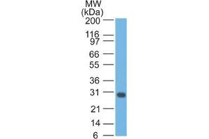 Western Blot Analysis of Jurkat cell lysate Bcl-x Mouse Monoclonal Antibody (BX006).