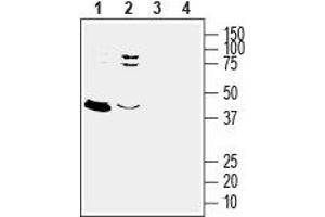 Western blot analysis of rat (lanes 1 and 3) and mouse (lanes 2 and 4) brain lysates: - 1,2. (Mesothelin 抗体  (Extracellular))