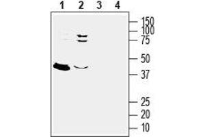 Western blot analysis of rat (lanes 1 and 3) and mouse (lanes 2 and 4) brain lysates: - 1,2. (GPER 抗体  (3rd Extracellular Loop))