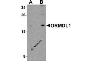 Western Blotting (WB) image for anti-ORM1-Like 1 (ORMDL1) antibody (ABIN1031784) (ORMDL1 抗体)