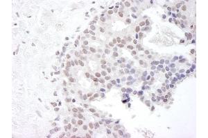Immunohistochemistry (IHC) image for anti-Gem (Nuclear Organelle) Associated Protein 4 (GEMIN4) (C-Term) antibody (ABIN7448579) (GEMIN4 抗体  (C-Term))