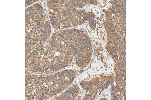 IHC analysis of Citrin/SLC25A13 using anti-Citrin/SLC25A13 antibody (ABIN7599512). (slc25a13 抗体  (AA 1-643))