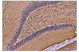 IHC analysis of CAMKIV/Camk4 using anti-CAMKIV/Camk4 antibody (ABIN7600419). (CAMK4 抗体  (AA 19-469))