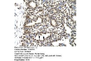 Immunohistochemistry (IHC) image for anti-General Transcription Factor IIH, Polypeptide 2, 44kDa (GTF2H2) (C-Term) antibody (ABIN2792641)