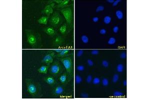 ABIN190808 Immunofluorescence analysis of paraformaldehyde fixed HeLa cells, permeabilized with 0. (TIA1 抗体  (Internal Region))