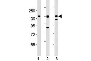 AXL antibody at 1:2000 dilution.