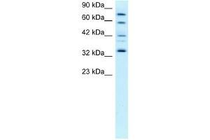 Western Blotting (WB) image for anti-Cyclin-Dependent Kinase 7 (CDK7) (C-Term) antibody (ABIN2792153)