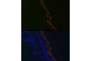 Immunofluorescence (IF) image for anti-TP53 Apoptosis Effector (PERP) antibody (ABIN7270861)