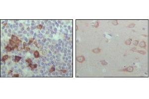 Immunohistochemical analysis of paraffin-embedded human lymph node (left) and brain (right), showing cytoplasmic localization with DAB staining using EhpB6 antibody. (EPH Receptor B6 抗体  (AA 601-750))