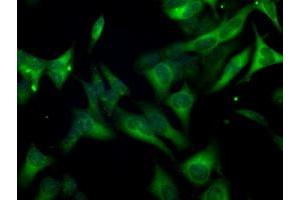 Image no. 6 for anti-Budding Uninhibited By Benzimidazoles 1 Homolog beta (Yeast) (BUB1B) antibody (ABIN1496996) (BUB1B 抗体)