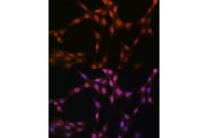 Immunofluorescence analysis of NIH-3T3 cells using Glutathione Synthetase (GSS) (GSS) Rabbit mAb (ABIN7267452) at dilution of 1:100 (40x lens). (Glutathione Synthetase 抗体)