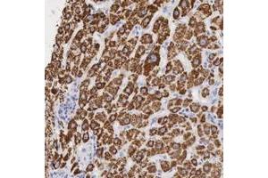 Immunohistochemical staining of human liver with OTC polyclonal antibody  shows cytoplasmic positivity in hepatocytes. (OTC 抗体  (AA 172-299))