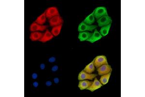 ABIN7095806 and ABIN7099868 staining Hela cells by IF/ICC. (SMOC2 抗体)