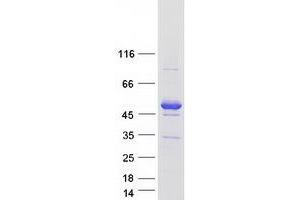 Western Blotting (WB) image for Ankyrin Repeat and Sterile alpha Motif Domain Containing 1B (ANKS1B) (Transcript Variant 3) protein (Myc-DYKDDDDK Tag) (ABIN2716160)