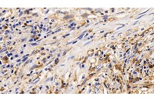 Immunohistochemistry (IHC) image for anti-Interleukin 13 Receptor, alpha 2 (IL13RA2) (AA 238-334) antibody (ABIN7437515)