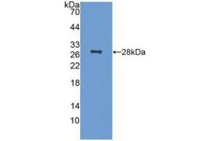 Detection of Recombinant NCL, Mouse using Polyclonal Antibody to Nucleolin (NCL) (Nucleolin 抗体  (AA 353-568))