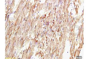 Formalin-fixed and paraffin embedded rat myocardium tissue labeled with Anti-AT1R/AGTR1 Polyclonal Antibody, Unconjugated (ABIN671121) at 1:200, followed by conjugation to the secondary antibody and DAB staining
