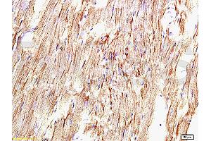 Formalin-fixed and paraffin embedded rat myocardium tissue labeled with Anti-AT1R/AGTR1 Polyclonal Antibody, Unconjugated (ABIN671121) at 1:200, followed by conjugation to the secondary antibody and DAB staining (Angiotensin II Type-1 Receptor 抗体)