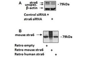Image no. 1 for anti-Stimulated By Retinoic Acid 6 (STRA6) (C-Term) antibody (ABIN374801) (STRA6 抗体  (C-Term))