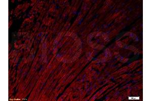 Formalin-fixed and paraffin embedded rat heart tissue labeled with Anti- Connexin-37/GJA4 Polyclonal Antibody, Unconjugated  at 1:200 followed by conjugation to the secondary antibody Goat Anti-Rabbit IgG, PE conjugated -PE) used at 1:200 dilution for 40 minutes at 37°C and DAPI. (GJA4 抗体  (AA 151-250))