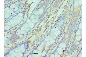 Immunohistochemistry of paraffin-embedded human colon tissue using ABIN7161752 at dilution of 1:100 (NCBP2 抗体  (AA 1-156))