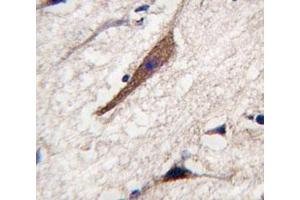 IHC analysis of FFPE human brain tissue stained with PAK5 antibody (PAK7 抗体  (AA 168-198))