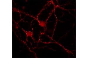 Indirect immunostaining of rat hippocampus neurons (dilution 1 : 100). (Doc 2a/b 抗体)