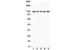 Western blot testing of C5a antibody and Lane 1:  rat liver;  2: mouse liver;  3: (m) NIH3T3;  4: (m) HEPA;  5: (r) PC12 lysate;  Predicted/Observed size: 115KD