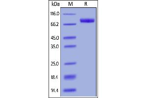 Human IL-6 R alpha, Fc Tag on  under reducing (R) condition. (IL6RA Protein (AA 20-365) (Fc Tag))