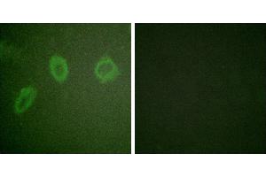 Peptide - +Immunofluorescence analysis of HuvEc cells, using ErbB2 antibody. (ErbB2/Her2 抗体  (Internal Region))