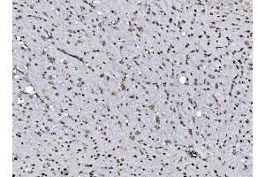 IHC analysis of DBC-1/CCAR2 using anti-DBC-1/CCAR2 antibody (ABIN7602235). (CCAR2 抗体  (AA 65-917))