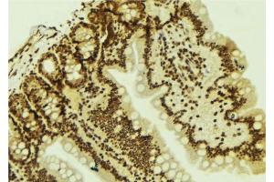 ABIN6277777 at 1/100 staining Mouse colon tissue by IHC-P. (LEF1 抗体  (Internal Region))