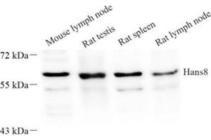 Western blot analysis of Haus8 (ABIN7074162) at dilution of 1: 250 (NYS48/HAUS8 抗体)
