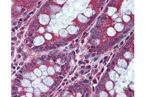 Immunohistochemistry (IHC) image for anti-Activin Receptor Type 1C (ACVR1C) (Internal Region) antibody (ABIN1048286)