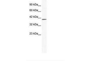 Image no. 1 for anti-Zinc Finger Protein 322A (ZNF322A) (AA 63-112) antibody (ABIN6735994) (ZNF322A 抗体  (AA 63-112))